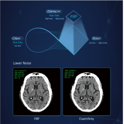 mri machine manufacturer